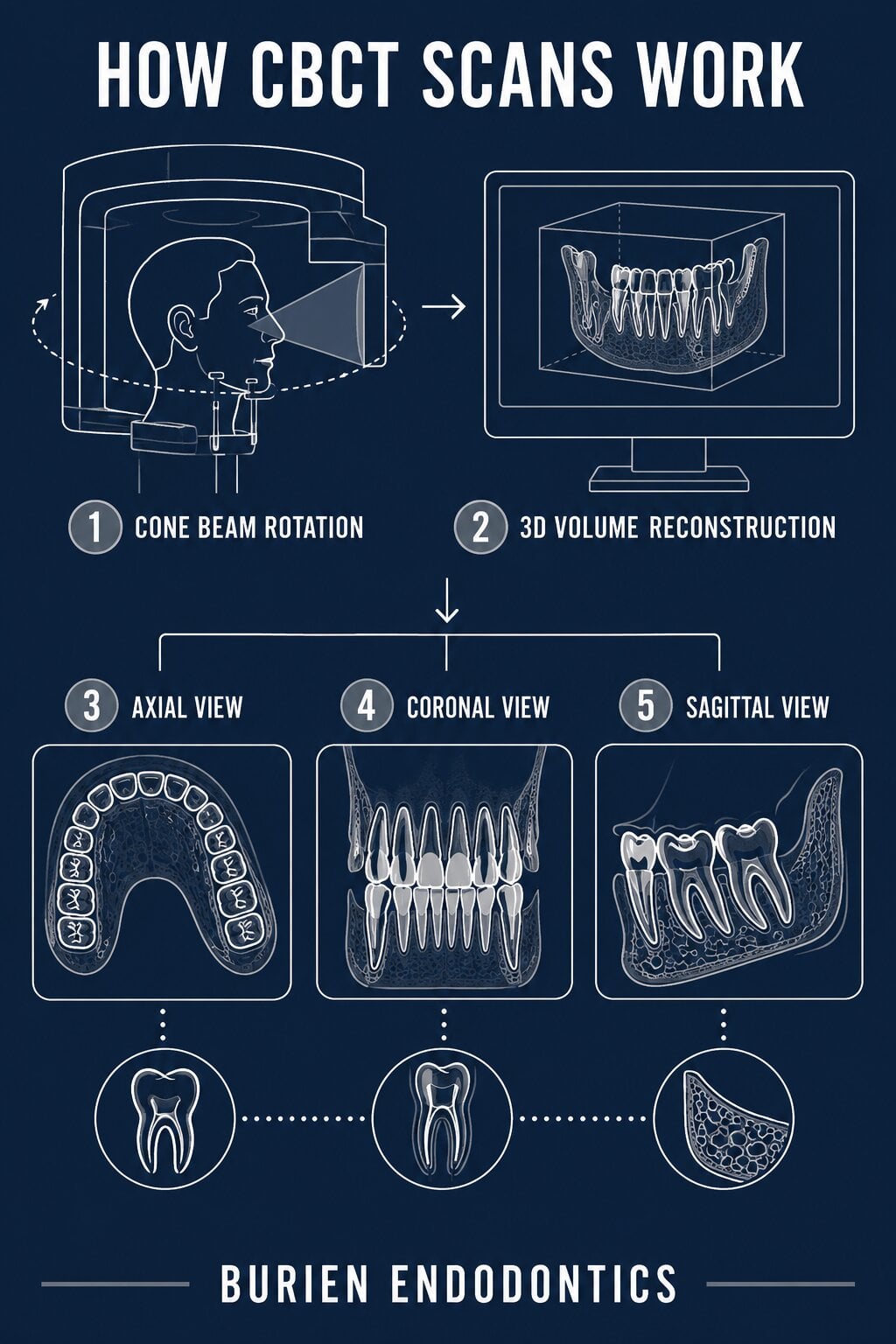 cbct